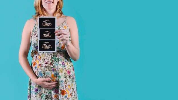 Фотографии и публичные проявления будущей мамы